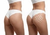 BOOTY Up ®- TRATAMIENTO POTENSIADOR DE GLUTEOS 100% EFCETIVO